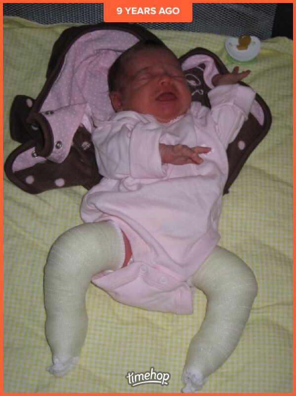 Sporty’s feet in her first set of casts. And she’s crying cause she was hungry. She was so incredibly little!